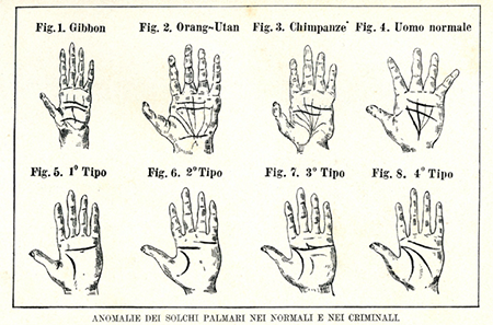 medium/medium-ASCLEPIO-75-02-e31-gf3.png