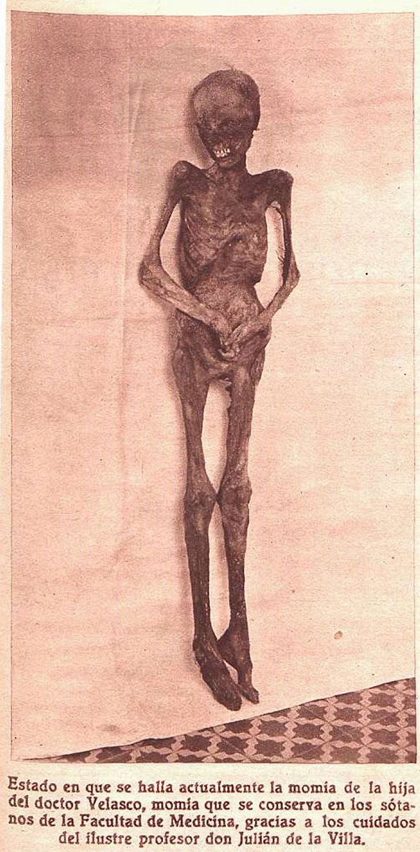 Presunta momia de la hija del doctor Velasco, conservada inicialmente en el museo de Atocha 90 y luego trasladada a la Facultad de Medicina de Madrid. En realidad, se trata de la momia de la hija del m&eacute;dico Manuel Tar&iacute;n, donada a Velasco en 1873 (Cr&oacute;nica, 7 de julio de 1935)