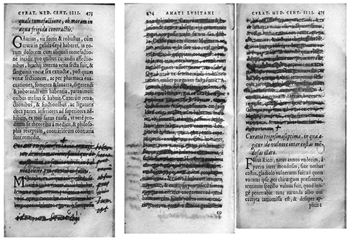 Excerpt of Curatio XXXVI, Centuriae IV, Venitiis, 1580, pp. 473-475
